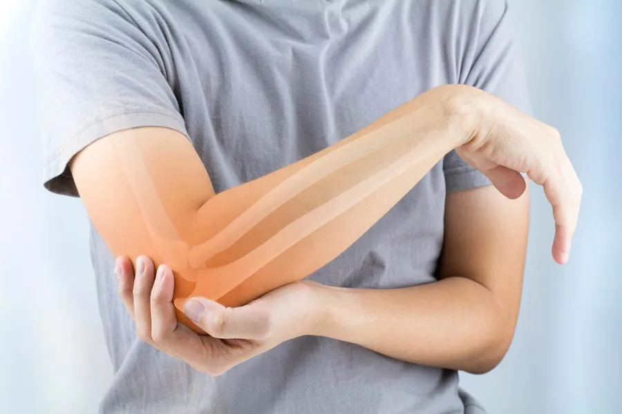 A close-up of a woman holding her elbow with an illustration of the bones and joint experiencing pain from osteoporosis. Get osteoporosis treatment from Tasmin Cordie, D.C. of Sage Functional Medicine in Marlboro Township.
